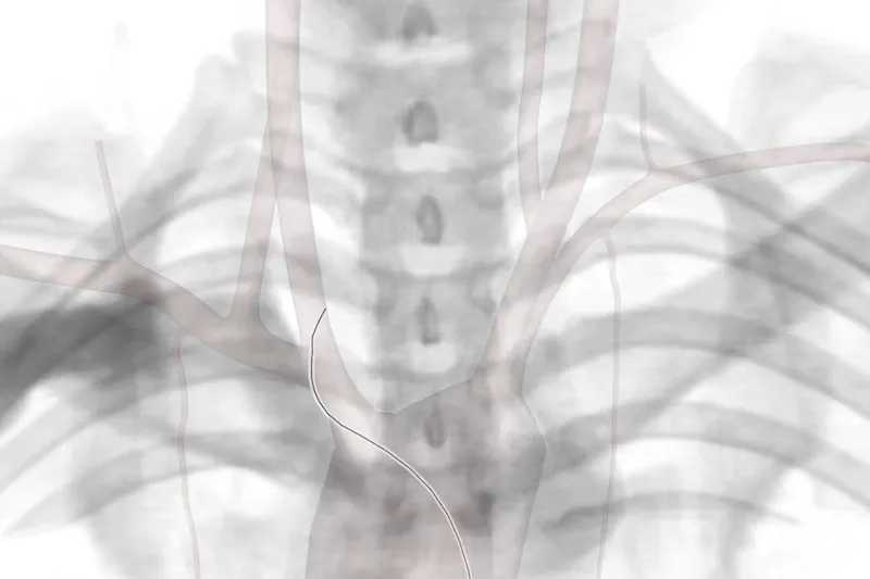 Interventional Radiology Simulator
