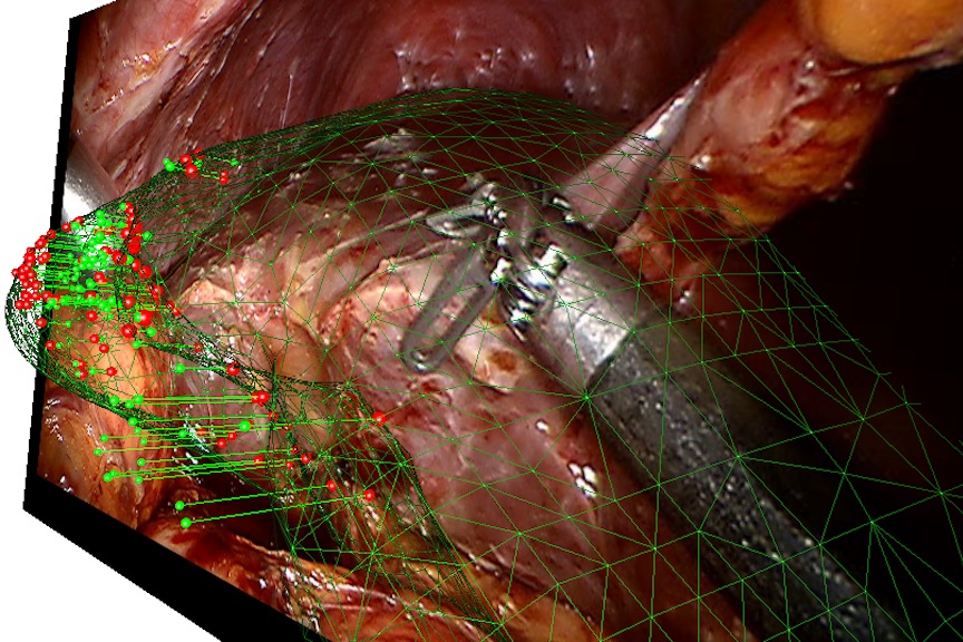 Augmented Reality of Deformable Objects